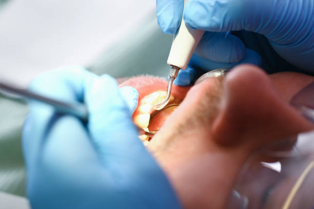 Best Cosmetic Emergency Dentistry in Fairfield, TX